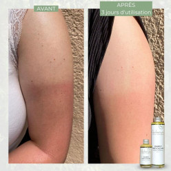 Liniment oléo-calcaire naturel certifié BIO (200ml)