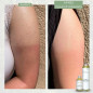 1 Liniment (200ml) + 1 Liniment (100ml) 1 Liniment (200ml) + 1 Liniment (100ml)