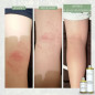 1 Liniment (200ml) + 1 Liniment (100ml) 1 Liniment (200ml) + 1 Liniment (100ml)