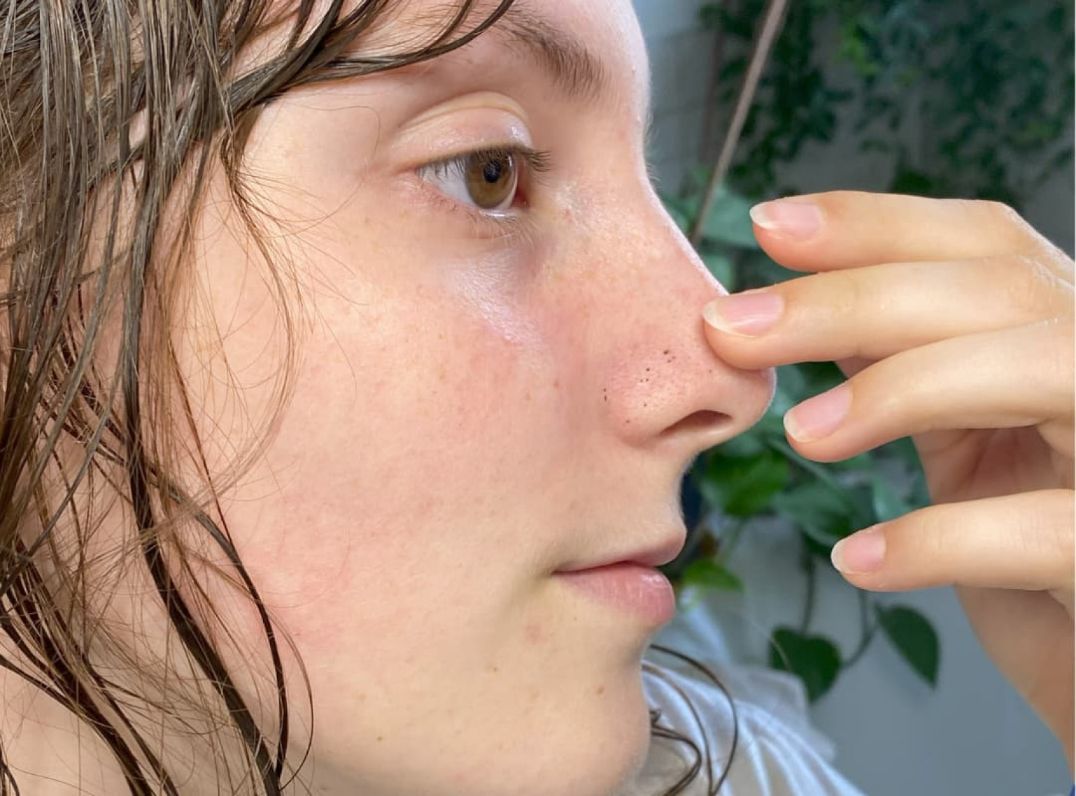 Découvrez la cause de vos boutons d'acné grâce au face mapping
